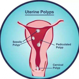 三代试管好胚囊多久着床
