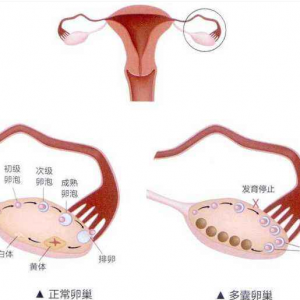 国内做*试管十万够不够附试管价格表